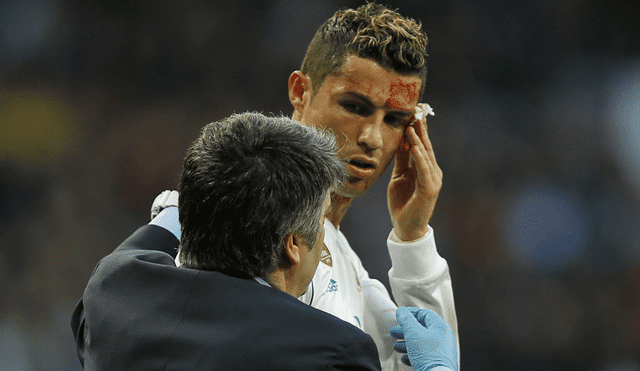 Real Madrid: Así quedó el ojo de Cristiano Ronaldo [FOTO]