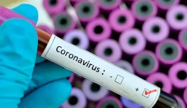 Minsa advierte que no existen medicinas para combatir el nuevo coronavirus