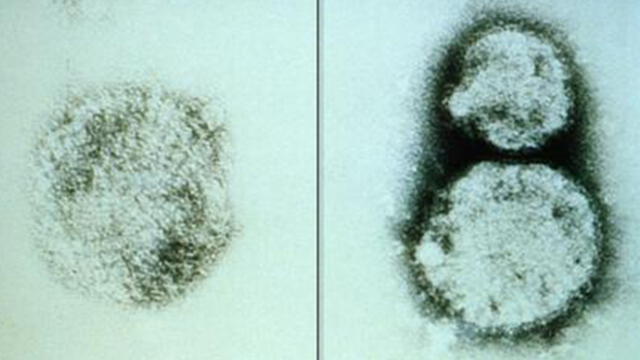 El hantavirus puede ser mortal, según la OMS. Foto: BBC.