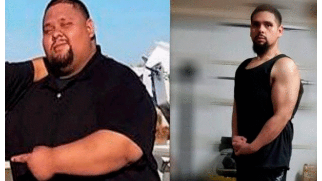 Hombre adelgaza 80 kilos para poder donarle riñón a su hermana