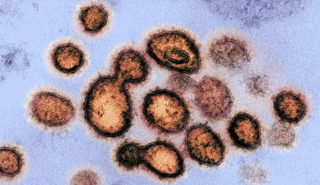 Partículas del coronavirus emergiendo de las células infectadas. Imagen de microscopio electrónico: NIAID.