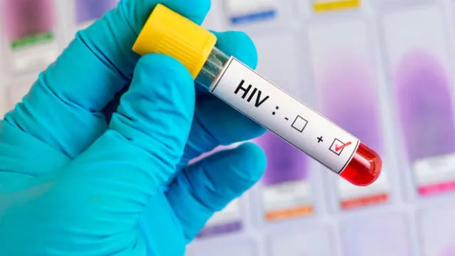 Salud México: pacientes de VIH y cáncer son grupos de riesgo ante la COVID-19 