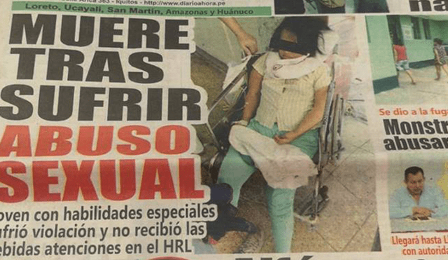Iquitos: Muere mujer con síndrome de down tras ser violada