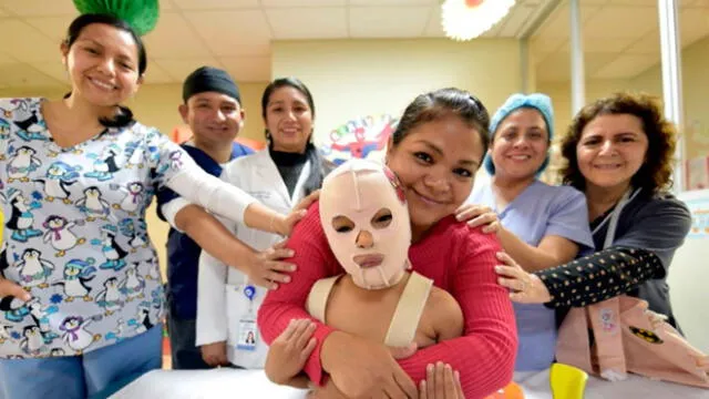 Médicos salvaron a niños víctimas de quemaduras mediante cirugías en los últimos seis años. Créditos: Andina.