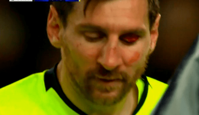 Barcelona vs Manchester United: Messi sufrió espeluznante corte tras duro choque