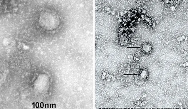 Imágenes del nuevo coronavirus (2019-nCov). Crédito: Instituto de Microbiología de la Academia de Ciencias de China.