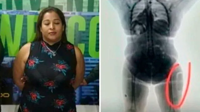 Mujer pretendía llegar a Madrid con cocaína implantada en sus muslos. Foto: AFP.