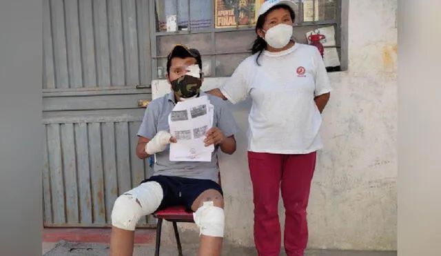 Heladero que fue atropellado por combi en Arequipa: “mis heridas siguen sangrando”