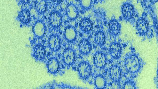 Muestra aislada del virus H1N1, causante de la pandemia de gripe porcina de 2009. Crédito: CDC.