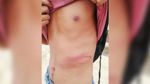 Tumbes: acusan a policía de haber agredido a menor de edad