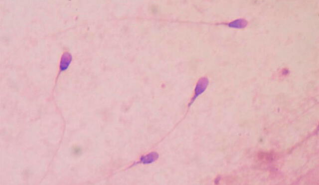 Un proceso clave en el desarrollo de los espermatozoides es el responsable de la fertilidad masculina. Imagen de laboratorio / Wikipedia.