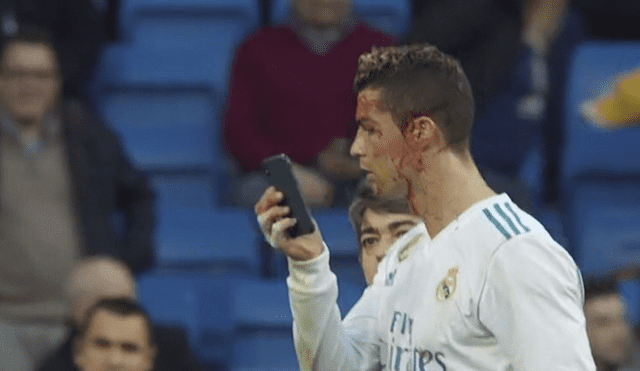 Real Madrid: el curioso gesto de Cristiano Ronaldo al ver su cara ensangrentada [VIDEO]