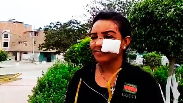 Lambayeque: desfiguran a extranjera tras defenderse de violación [VIDEO]
