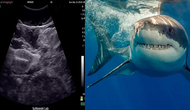 Video es viral en Facebook. Impactantes imágenes muestran el ultrasonido de un tiburón tigre retorciéndose en el útero de su madre