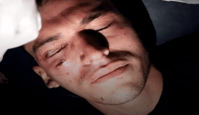 Arquero recibió brutal golpe en la cara y terminó con un edema en la retina [VIDEO]