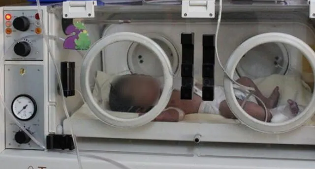 Bebé que nació con el corazón fuera del cuerpo en Puno es trasladado a Lima.