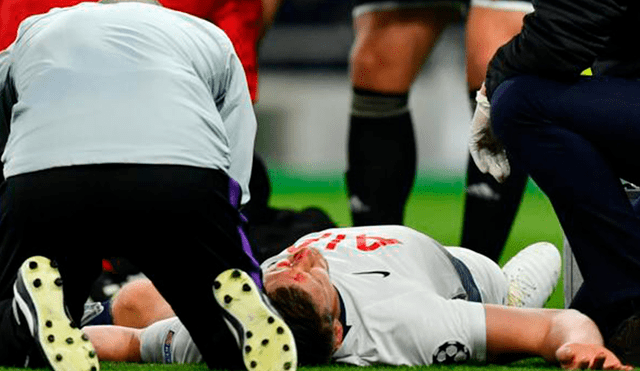 Tottenham vs Ajax: Jan Vertonghen salió lesionado tras chocar con su propio compañero [VIDEO]