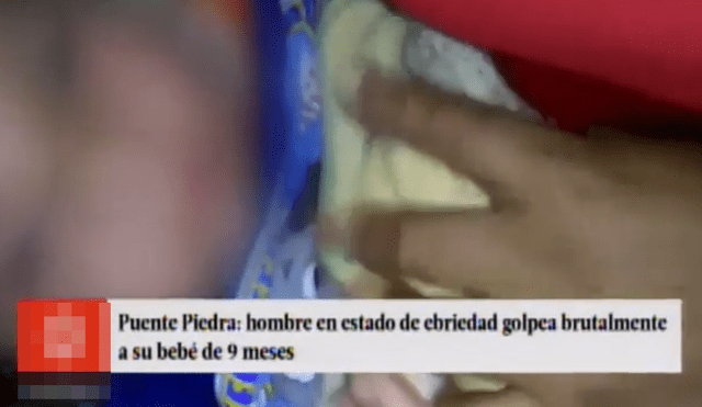 Puente Piedra: padre golpeó y desfiguró brutalmente a su bebé de 9 meses [VIDEO y FOTOS]