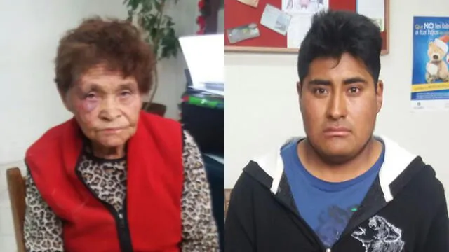 Arequipa: Anciana termina ensangrentada tras discusión con cobrador