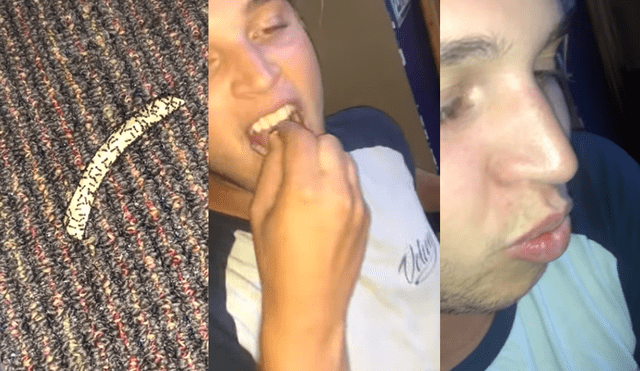 YouTube: lo retan a comer papa frita llena de hormigas, él acepta y luego reacciona así [VIDEO]