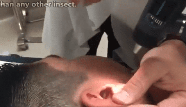 Facebook viral: nunca imaginarás la aterradora criatura que encontró este joven dentro de su oído [VIDEO] 