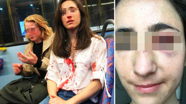 Cuatro adolescentes detenidos por el brutal ataque a pareja de lesbianas 