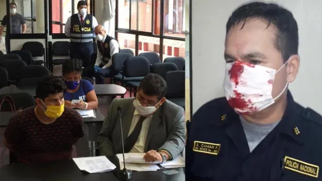 Investigado podría afrontar una pena de hasta 12 de cárcel por causar lesiones a un policía durante el cumplimiento de sus funciones. (Foto: Corte de Justicia de Lima Norte)