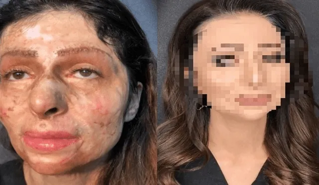 Instagram: maquillan a mujer con rostro desfigurado y su cambio es impactante [VIDEO]