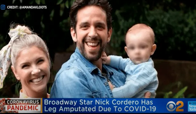 Nick Cordero, actor de Brodway, sufre la amputación de una pierna por el coronavirus
