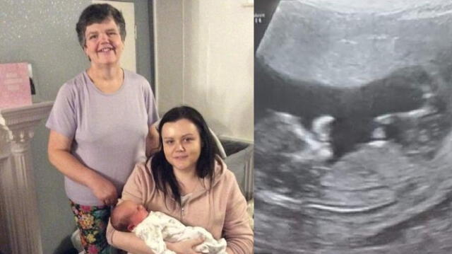 Su hija nació sin matriz: ella, de 55 años, le 'prestó' su vientre para que fuera mamá