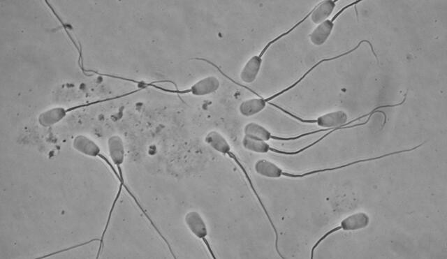 Espermatozoides bajo un microscopio. Foto: University of Wisconsin