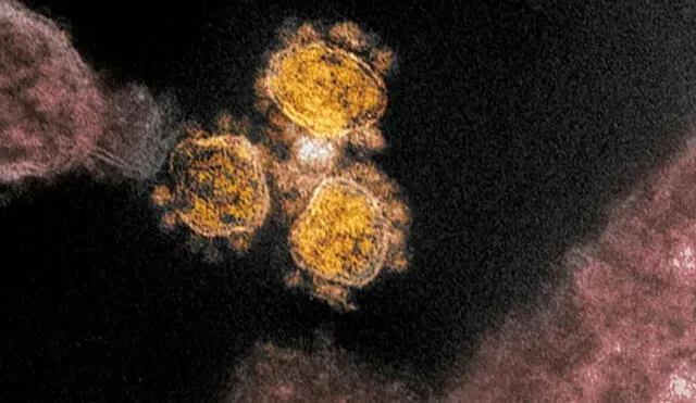 Imagen de microscopio electrónico muestra al coronavirus que causa COVID-19. Fuente: NIAID.