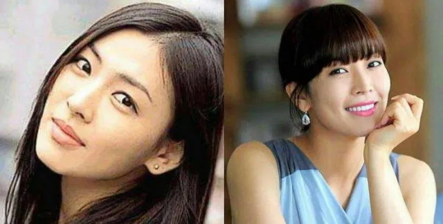 El antes y después de Heo Young Mi.