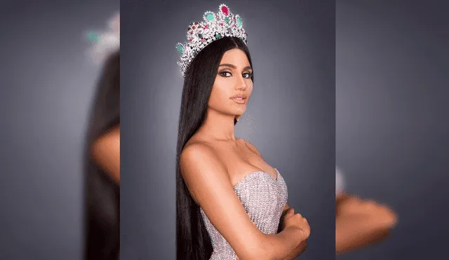 Filtran inéditas imágenes de Miss Venezuela antes de operaciones en el rostro