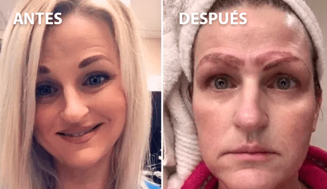 Facebook viral: así quedó una mujer que se sometió a un tratamiento de tatuaje de cejas [VIDEO]