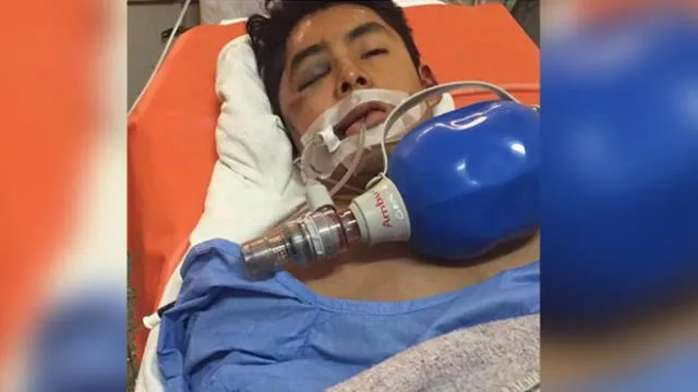 Buscan identificar a joven que murió tras caer violentamente de mototaxi en Arequipa 