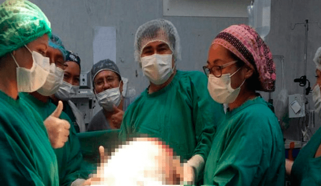 Cirujanos peruanos extraen tumor de 15 kilogramos a mujer en Ventanilla