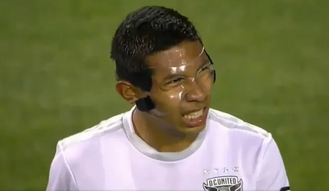 Edison Flores sufrió una lesión facial a fines de agosto en un partido de la MLS. Foto: Captura de ESPN