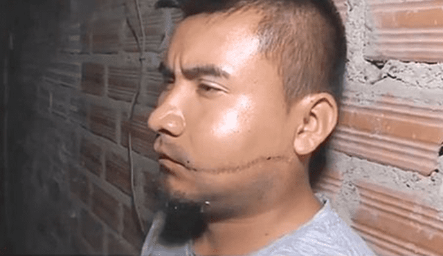 SJL: hombre quedó desfigurado y terminó siendo denunciado por su agresor [VIDEO] 