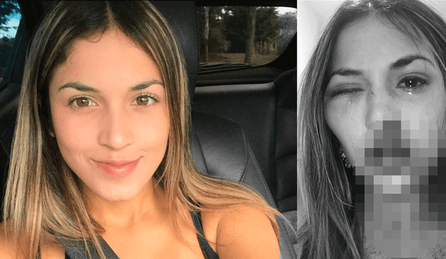 Colombia: Abogada mostró cómo quedó su rostro tras brutal agresión de su novio