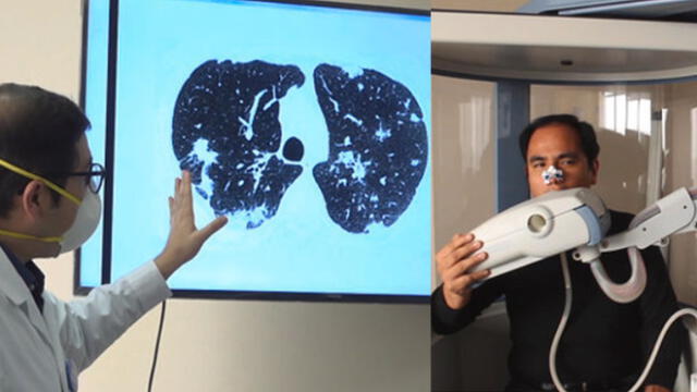 Las pruebas serán importantes para medir el impacto que la enfermedad del virus ha tenido en la capacidad pulmonar. (Foto: EsSalud)
