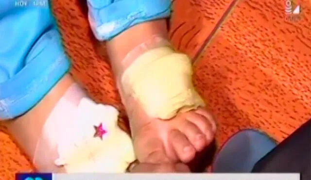 Padre castigó a su hija quemando sus manos y pies con cuchara caliente [VIDEO]
