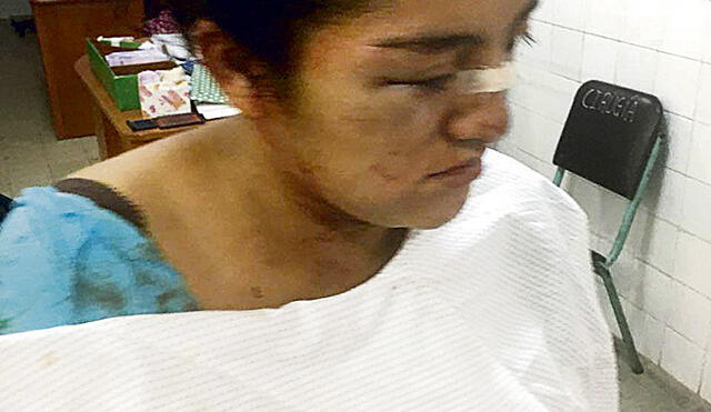 Salvaje masacró a su sobrina, la dejó inconsciente y ensangrentada en Chimbote