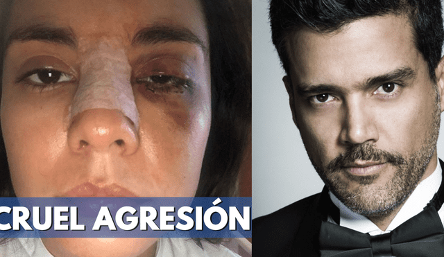 Actriz Eileen Moreno detalla cómo fue la brutal agresión por parte de actor colombiano