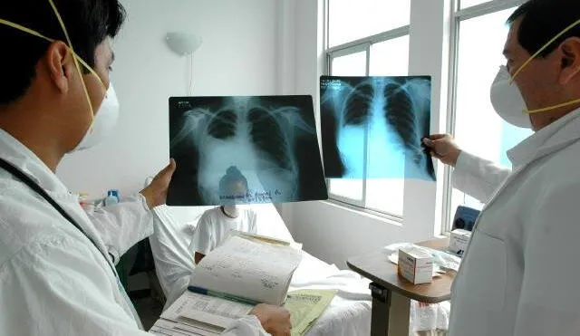 Huancavelica: implementan nuevo tratamiento para pacientes con tuberculosis