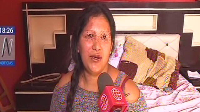 Callao: mujer denunció a su pareja por agresión física [VIDEO]