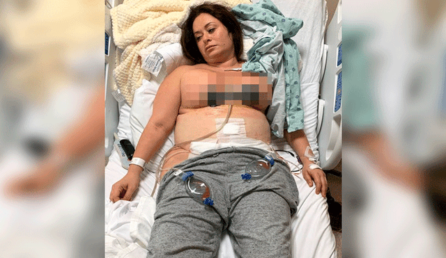 Mujer termina con la piel “podrida” luego de intentar operarse los pechos y el abdomen