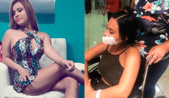 Instagram: Thamara Gómez se recuperó y lució su rostro tras accidente [FOTO]