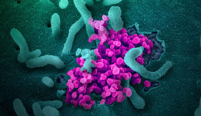 Miles de partículas del coronavirus saliendo de las células humanas. Imagen: Nature.