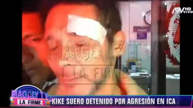 Kike Suero pelea con detenido en comisaría y termina con la ceja rota